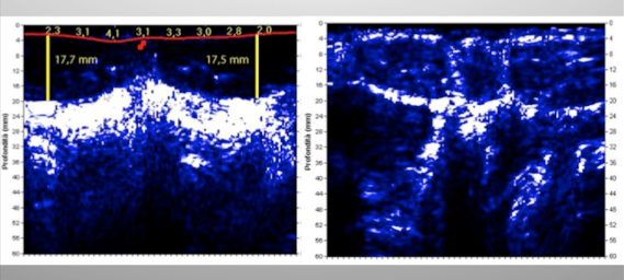 Schermata 2017-08-19 alle 15.35.22